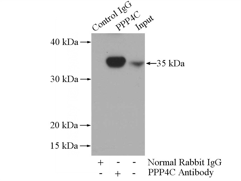 IP Result of anti-PPP4C (IP:Catalog No:114116, 4ug; Detection:Catalog No:114116 1:1000) with mouse kidney tissue lysate 4000ug.