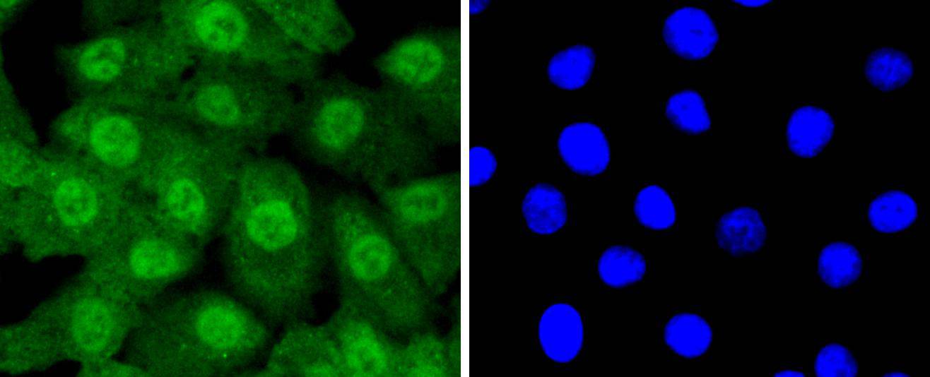 Fig4:; ICC staining of Ubiquitin-like modifier-activating enzyme 1 in A549 cells (green). Formalin fixed cells were permeabilized with 0.1% Triton X-100 in TBS for 10 minutes at room temperature and blocked with 1% Blocker BSA for 15 minutes at room temperature. Cells were probed with the primary antibody ( 1/50) for 1 hour at room temperature, washed with PBS. Alexa Fluor®488 Goat anti-Rabbit IgG was used as the secondary antibody at 1/1,000 dilution. The nuclear counter stain is DAPI (blue).