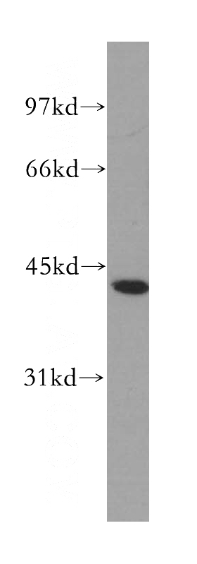 mouse testis tissue were subjected to SDS PAGE followed by western blot with Catalog No:113976(PNMA1 antibody) at dilution of 1:500