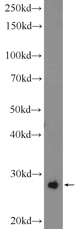 SMMC-7721 cells were subjected to SDS PAGE followed by western blot with Catalog No:109521(CPPED1 Antibody) at dilution of 1:300