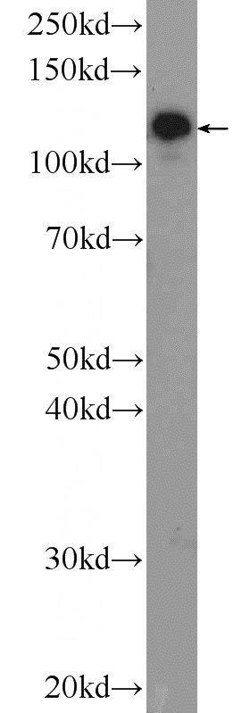 rat brain tissue were subjected to SDS PAGE followed by western blot with Catalog No:108122(AP3B2 Antibody) at dilution of 1:600