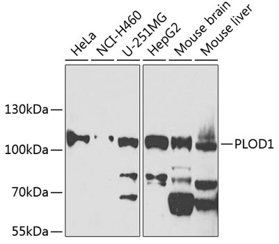 Western blot - PLOD1 Polyclonal Antibody 
