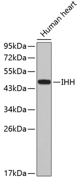 Western blot - IHH Polyclonal Antibody 
