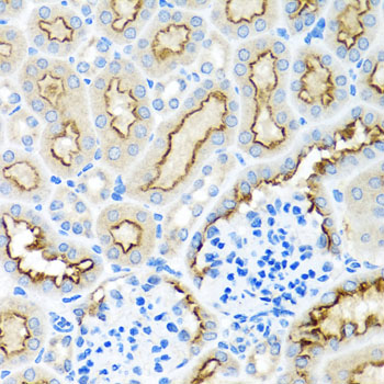 Immunohistochemistry - RPS2 Polyclonal Antibody 