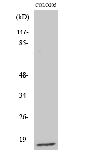 Fig1:; Western Blot analysis of various cells using Ribosomal Protein L27A Polyclonal Antibody diluted at 1: 2000