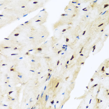 Immunohistochemistry - ZBTB17 Polyclonal Antibody 