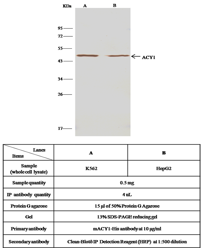 Mouse Aminoacylase-1/ACY1 Immunoprecipitation(IP) 14738