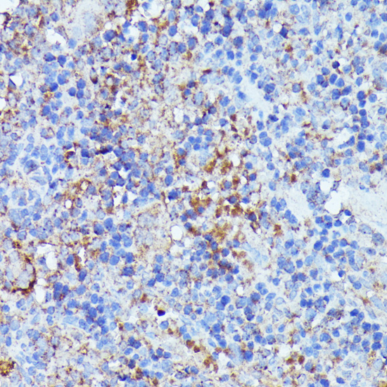 Immunohistochemistry - SEPT1 Polyclonal Antibody 