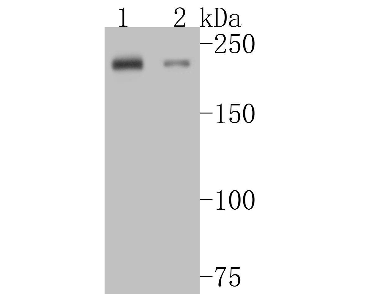 Fig1:; Western blot analysis of MYH7B on different lysates. Proteins were transferred to a PVDF membrane and blocked with 5% BSA in PBS for 1 hour at room temperature. The primary antibody ( 1/500) was used in 5% BSA at room temperature for 2 hours. Goat Anti-Rabbit IgG - HRP Secondary Antibody (HA1001) at 1:5,000 dilution was used for 1 hour at room temperature.; Positive control:; Lane 1: rat skeletal muscle tissue lysate; Lane 2: rat heart tissue lysate