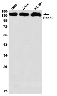 Western blot detection of Rad50 in Hela,A549,HL-60 using Rad50 Rabbit mAb(1:1000 diluted)