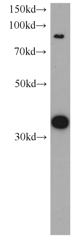 human brain tissue were subjected to SDS PAGE followed by western blot with Catalog No:109659(CYC1 antibody) at dilution of 1:300