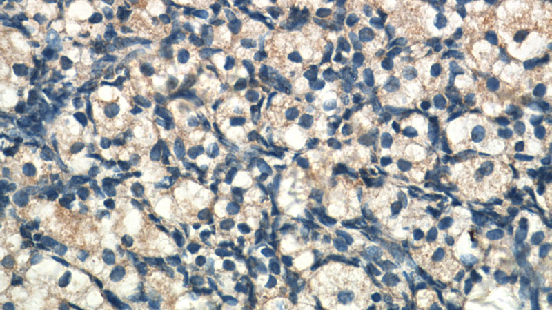 Immunohistochemistry of paraffin-embedded human ovary tissue slide using Catalog No:117041(ZFP36L1 Antibody) at dilution of 1:50 (under 40x lens)