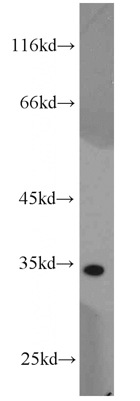 MCF7 cells were subjected to SDS PAGE followed by western blot with Catalog No:112814(MRPL15 antibody) at dilution of 1:1000