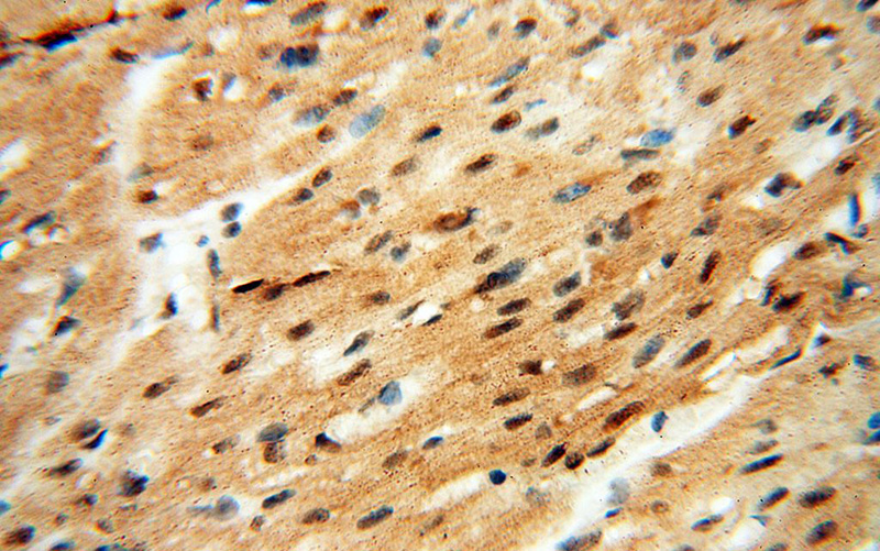 Immunohistochemical of paraffin-embedded human heart using Catalog No:111702(HSPB8 antibody) at dilution of 1:50 (under 40x lens)