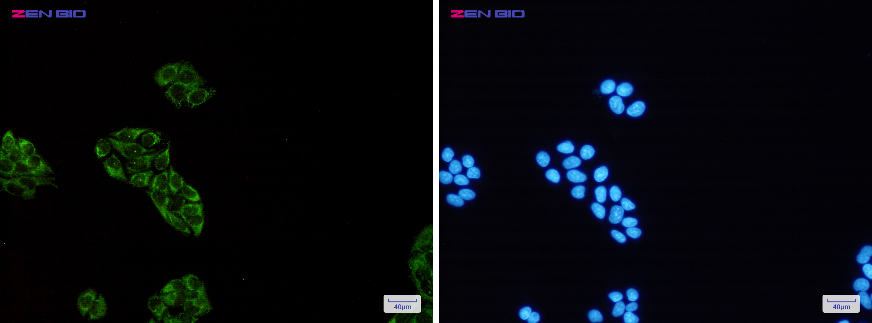 Immunocytochemistry of USP10(green) in Hela cells using USP10 Rabbit pAb at dilution 1/50, and DAPI(blue)