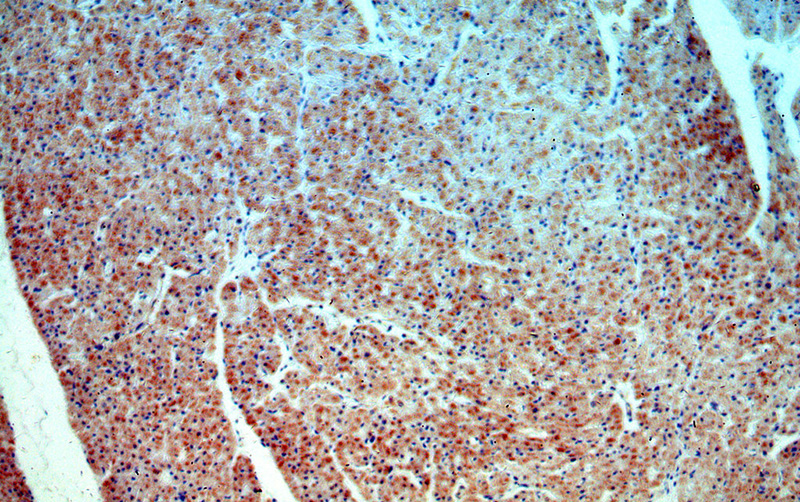 Immunohistochemical of paraffin-embedded human heart using Catalog No:116349(TRAPPC9 antibody) at dilution of 1:100 (under 10x lens)