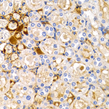 Immunohistochemistry - TFF1 Polyclonal Antibody 