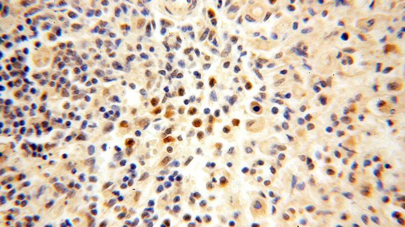 Immunohistochemical of paraffin-embedded human spleen using Catalog No:113158(NFKB2,p52,p100-Specific antibody) at dilution of 1:50 (under 40x lens)