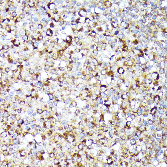 Immunohistochemistry - RIPK1 Polyclonal Antibody 