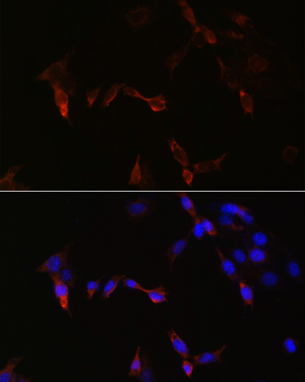 Immunofluorescence - PLA2G5 Polyclonal Antibody 