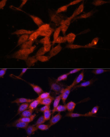 Immunofluorescence - PGC1 alpha Polyclonal Antibody 