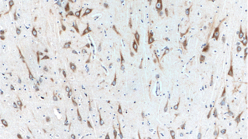 Immunohistochemistry of paraffin-embedded human brain tissue slide using Catalog No:114943(RXFP1 Antibody) at dilution of 1:100 (under 10x lens).