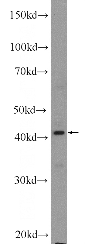L02 cells were subjected to SDS PAGE followed by western blot with Catalog No:113035(NCF4 Antibody) at dilution of 1:300