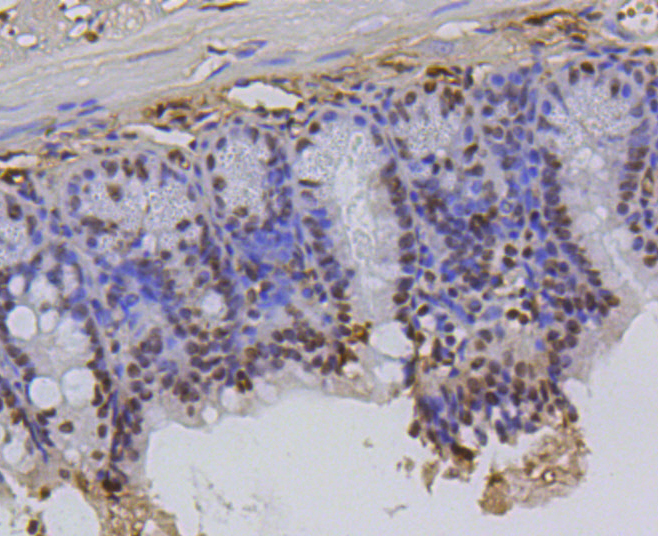 Immunohistochemistry - Hydroxyl-Histone H2A-Y39 Monoclonal Antibody 