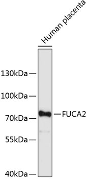 Western blot - FUCA2 Polyclonal Antibody 