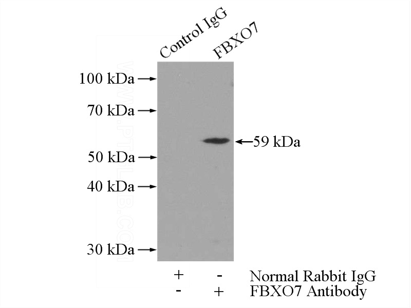 IP Result of anti-FBXO7 (IP:Catalog No:110558, 3ug; Detection:Catalog No:110558 1:800) with mouse testis tissue lysate 4000ug.