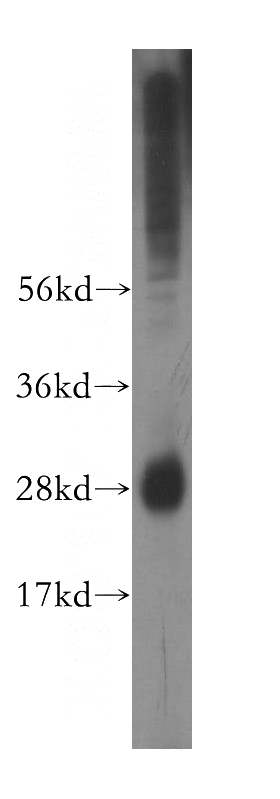 human colon tissue were subjected to SDS PAGE followed by western blot with Catalog No:111615(IFI30 antibody) at dilution of 1:400