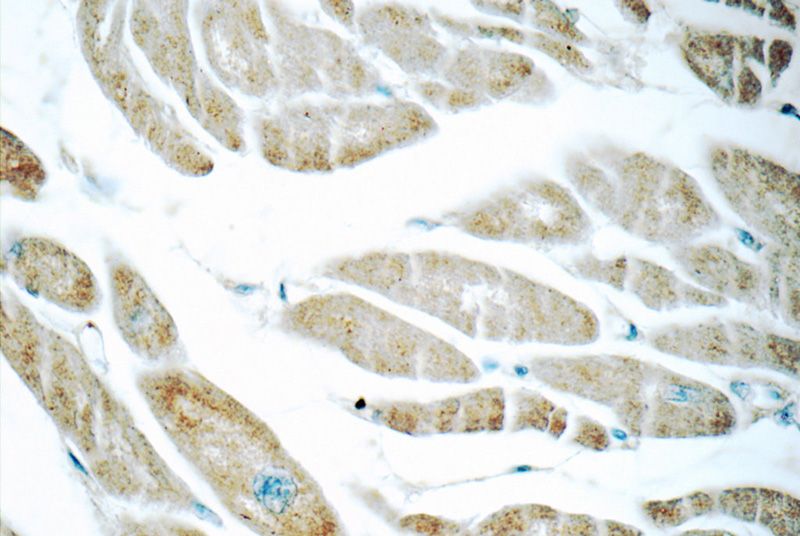 Immunohistochemistry of paraffin-embedded human heart tissue slide using Catalog No:111723(humanin Antibody) at dilution of 1:50 (under 40x lens)