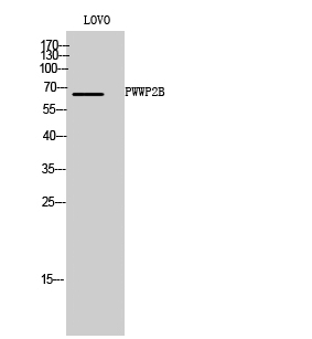 Fig1:; Western Blot analysis of LOVO cells using PWWP2B Polyclonal Antibody