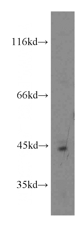 human placenta tissue were subjected to SDS PAGE followed by western blot with Catalog No:107773(ADAP2 antibody) at dilution of 1:200