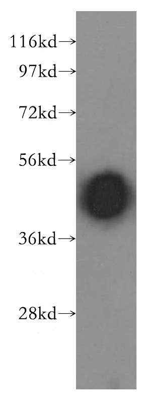 human brain tissue were subjected to SDS PAGE followed by western blot with Catalog No:108173(ARR3 antibody) at dilution of 1:500