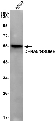 Western blot detection of DFNA5/GSDME in A549 cell lysates using DFNA5/GSDME Rabbit pAb(1:1000 diluted).Predicted band size:55KDa.Observed band size:55KDa.