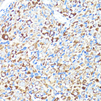 Immunohistochemistry - CNR1 Polyclonal Antibody 