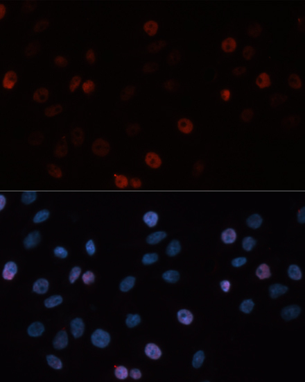 Immunofluorescence - DNMT3B Polyclonal Antibody 