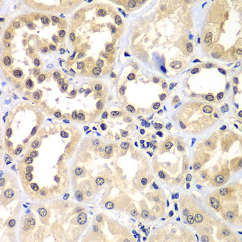 Immunohistochemistry - ZNF264 Polyclonal Antibody 