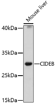 Western blot - CIDEB Polyclonal Antibody 