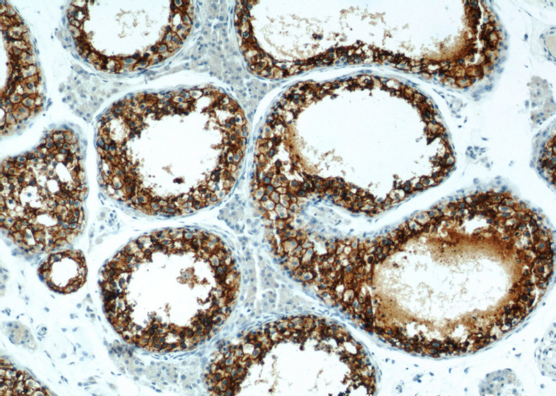 Immunohistochemistry of paraffin-embedded human testis slide using Catalog No:110763(G3BP1 Antibody) at dilution of 1:50