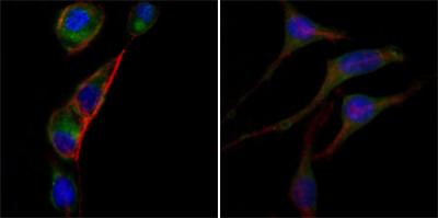 Immunofluorescence analysis of PC-3 (left) and SK-BR-3 (right) cells using anti-GOT2 mAb (green). Red: Actin filaments have been labeled with DY-554 phalloidin. Blue: DRAQ5 fluorescent DNA dye.