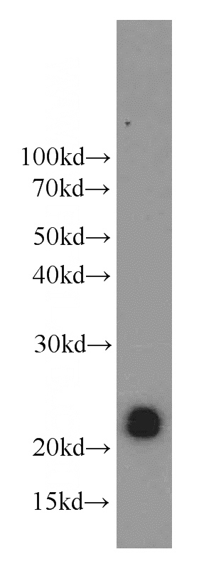 Y79 cells were subjected to SDS PAGE followed by western blot with Catalog No:109513(CPLX4 antibody) at dilution of 1:1500
