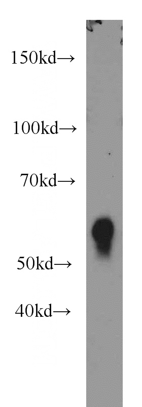 mouse thymus tissue were subjected to SDS PAGE followed by western blot with Catalog No:109119(CD4 antibody) at dilution of 1:1000