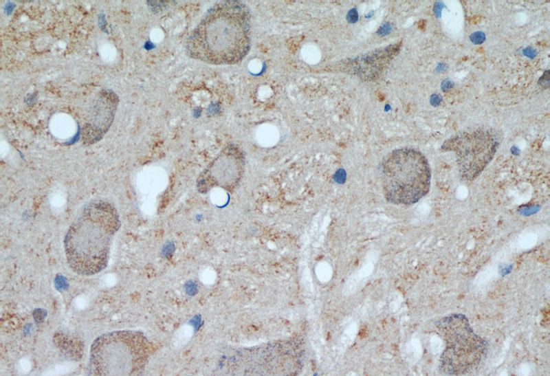 Immunohistochemical of paraffin-embedded rat brain using Catalog No:116545(UCP1 antibody) at dilution of 1:50 (under 40x lens)