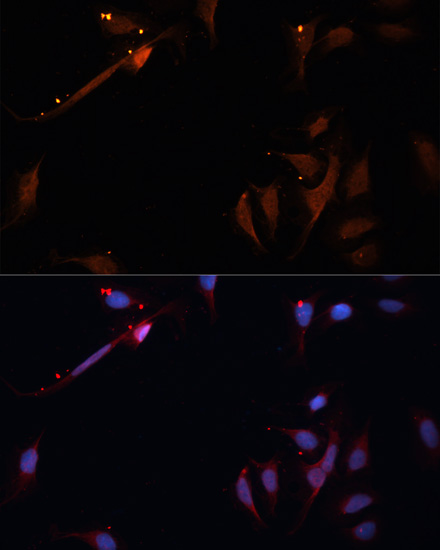Immunofluorescence - LPL Polyclonal Antibody 