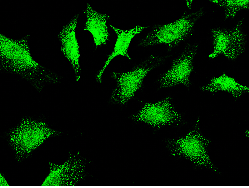Mouse Thioredoxin/TXN/SASP Immunofluorescence(IF) 15679