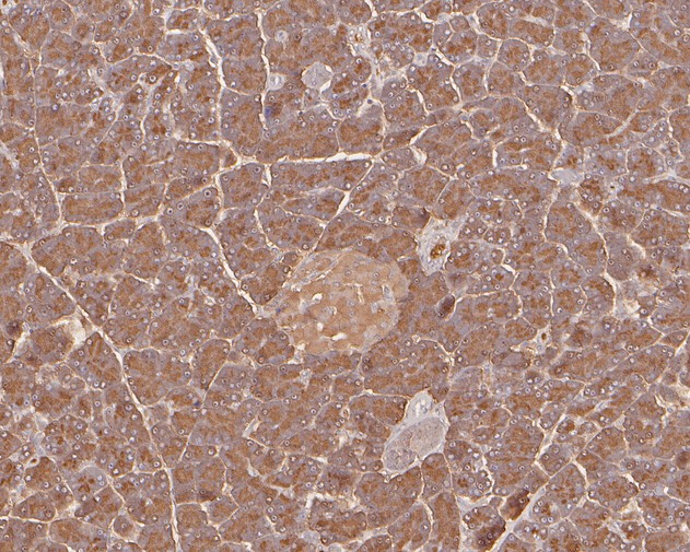Fig2:; Immunohistochemical analysis of paraffin-embedded rat pancreas tissue using anti-PRSS2 antibody. The section was pre-treated using heat mediated antigen retrieval with Tris-EDTA buffer (pH 8.0-8.4) for 20 minutes.The tissues were blocked in 5% BSA for 30 minutes at room temperature, washed with ddH; 2; O and PBS, and then probed with the primary antibody ( 1/800) for 30 minutes at room temperature. The detection was performed using an HRP conjugated compact polymer system. DAB was used as the chromogen. Tissues were counterstained with hematoxylin and mounted with DPX.