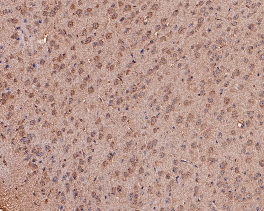 Fig4:; Immunohistochemical analysis of paraffin-embedded mouse brain tissue using anti-NMBR antibody. The section was pre-treated using heat mediated antigen retrieval with Tris-EDTA buffer (pH 9.0) for 20 minutes.The tissues were blocked in 1% BSA for 30 minutes at room temperature, washed with ddH; 2; O and PBS, and then probed with the primary antibody ( 1/400) for 30 minutes at room temperature. The detection was performed using an HRP conjugated compact polymer system. DAB was used as the chromogen. Tissues were counterstained with hematoxylin and mounted with DPX.