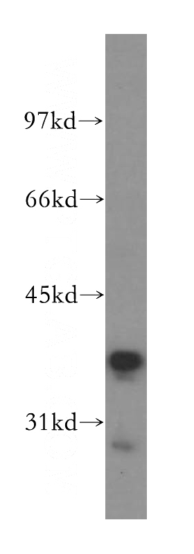 human liver tissue were subjected to SDS PAGE followed by western blot with Catalog No:114624(RFC3 antibody) at dilution of 1:500